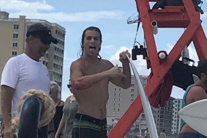 JOVEM SURFISTA TOMA DECISÃO INSÓLITA APÓS SER ATACADO POR UM TUBARÃO