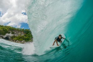Dylan Fachadas, jovem português residente em Bali, partiu a perna durante uma surfada