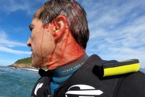 CARLOS BURLE PERDE OS SENTIDOS DURANTE UMA FORTE QUEDA NUMA SESSÃO DE FREE SURF